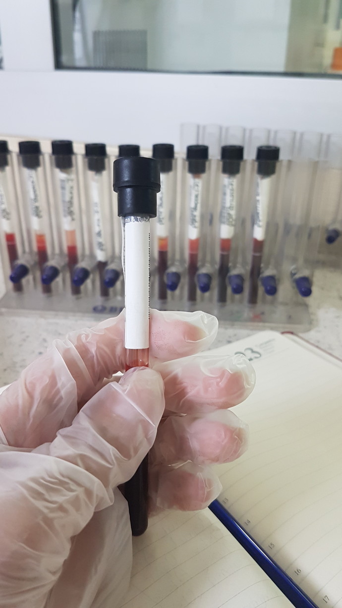 2 doz Sinovac olanlara 3. Doz Biontech aşısı yapılmasını nasıl değerlendiriyorsunuz?
