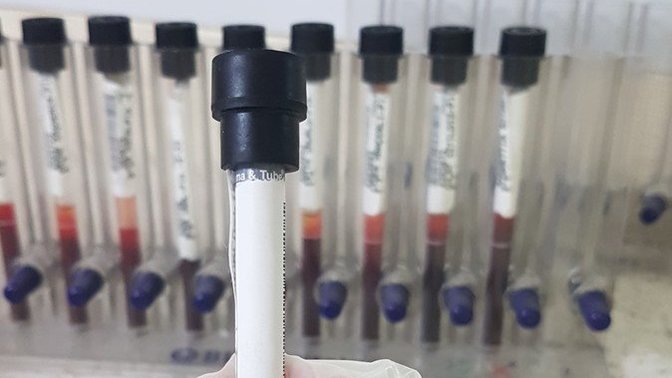 2 doz Sinovac olanlara 3. Doz Biontech aşısı yapılmasını nasıl değerlendiriyorsunuz?