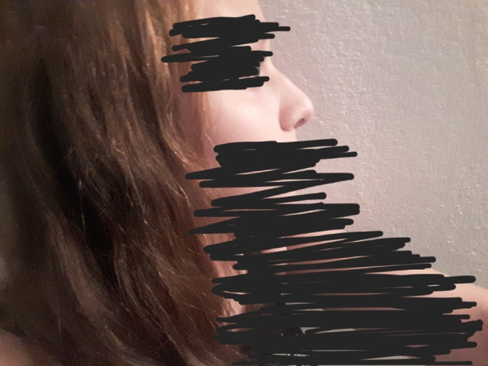 Burnumdan çok rahatsız oluyorum. Nasıl düzeltebilirim?