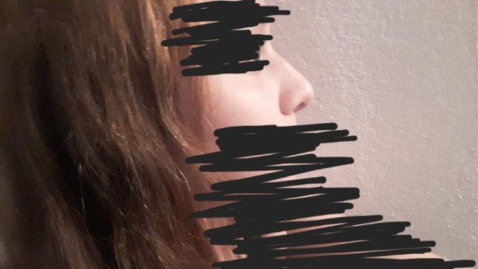 Burnumdan çok rahatsız oluyorum. Nasıl düzeltebilirim?