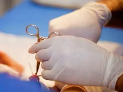 Sünet olmanın yaşı var mı sizce?