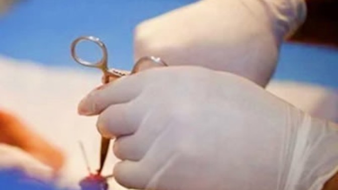 Sünet olmanın yaşı  var mı sizce?