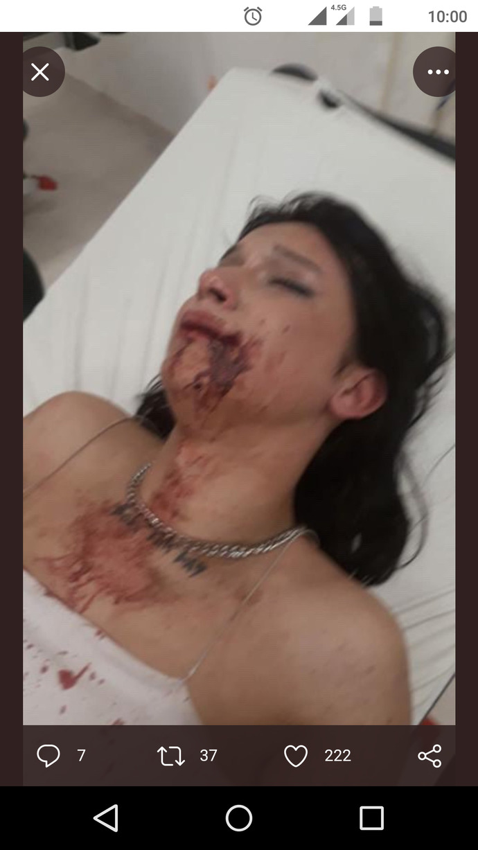 Sana bunu yaşatan ibnelerin...