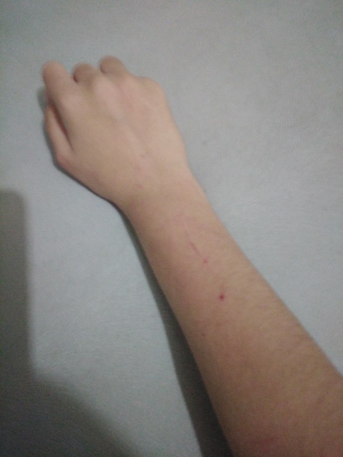 Kedim çok pis saldırıyor, her yerim kan içinde kalıyor. Ne yapabilirim?