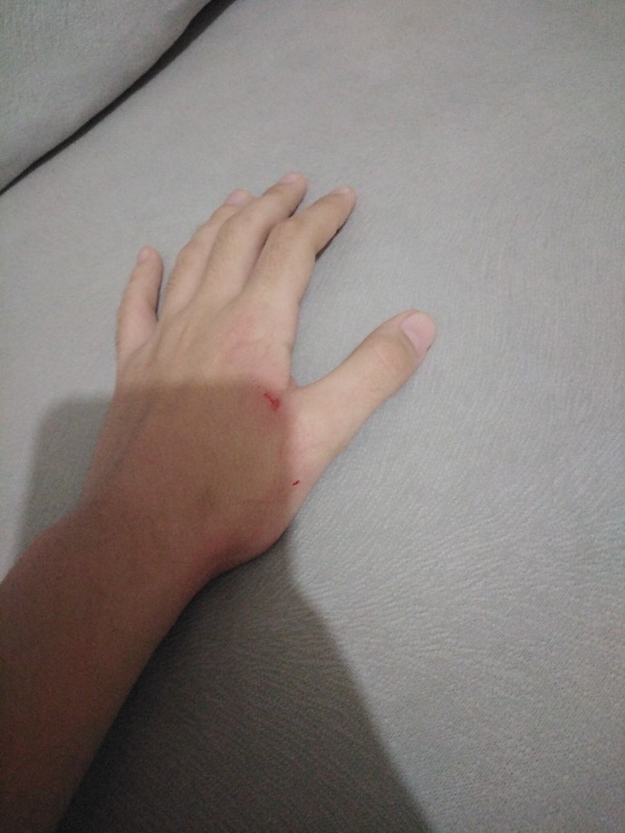 Kedim çok pis saldırıyor, her yerim kan içinde kalıyor. Ne yapabilirim?