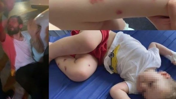 1,5 yaşındaki bebeğine işkence eden kişi komşuları tarafından hastanelik edildi. Siz böyle bir durumla karşılaşsanız ne yaparsınız?