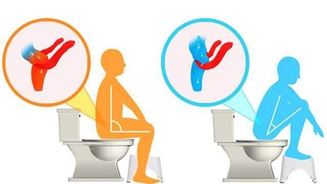 Klozete 90 ° lik acıyla oturmak hazımsızlık yapıyor klozete doğru şekilde oturuyor musunuz?