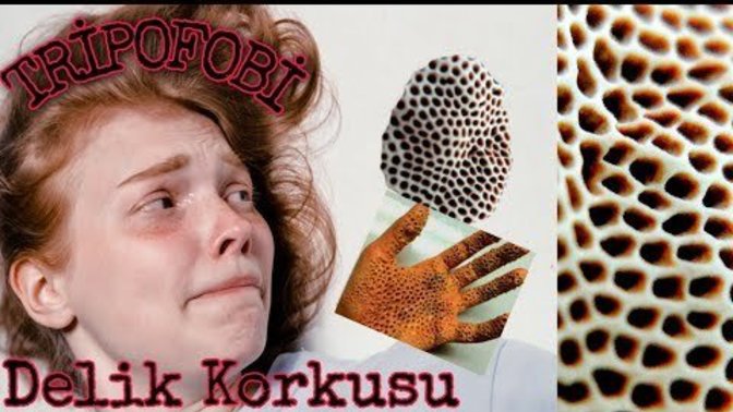 Tripofobiniz var mı? Delikler sizi korkutur mu?