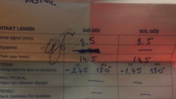 Lens muayenesinde verilen reçeteye göre lens aldım batıyor, lens batması nasıl geçer?