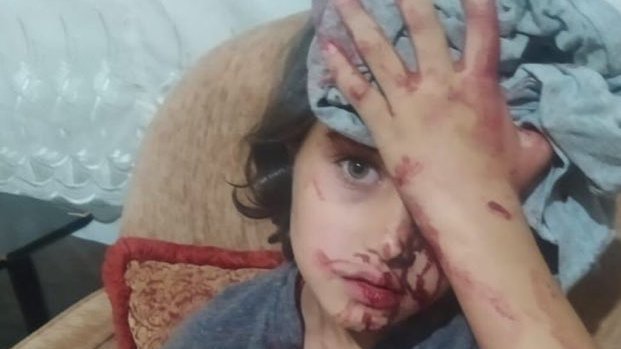 Bu doğru mu gerçekten, Türk milleti suriyelilere olan öfkesini bir çocuktan mı çıkardı?