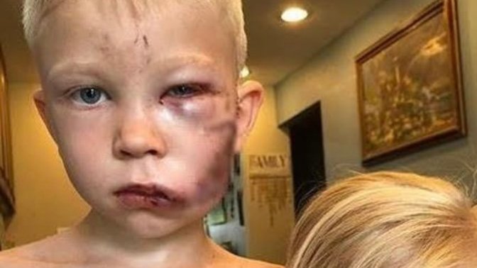 Kardeşini korumak için köpekle boğuşan çocuğu Dünya Boks Konseyi "Dünya Şampiyonu"ilan etti. Kardeşin için kavga eder misin?