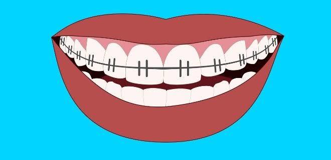 Diş ipi nasıl kullanılır? Diş ipiyle diş temizliği nasıl yapılır?
