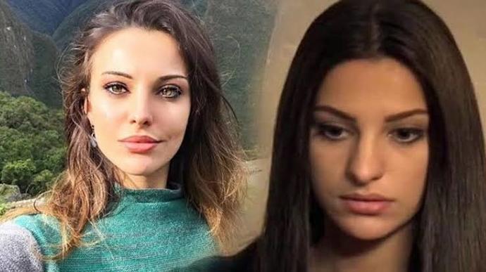 Güzellik uğruna estetik ameliyatı olur musunuz?