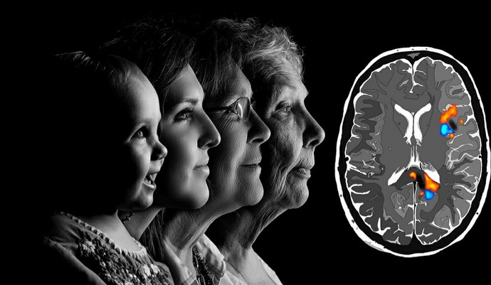 Alzheimer hastalığına yakalanmaktan korkuyorum. Bu düşünceyi nasıl aşarım?
