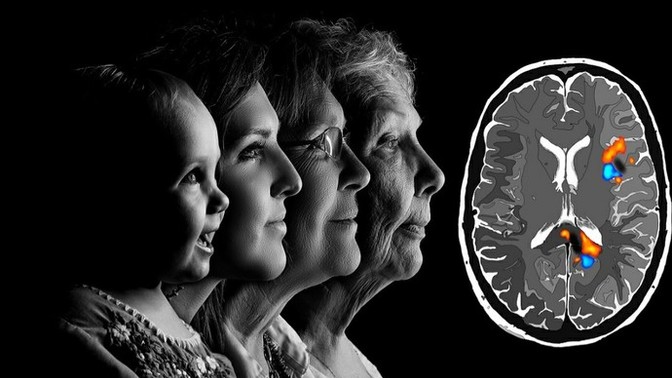 Alzheimer hastalığına yakalanmaktan korkuyorum. Bu düşünceyi nasıl aşarım?