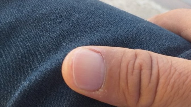 Tırnak Altı Boşluğu Diye Bir Sorun mu Varmış?