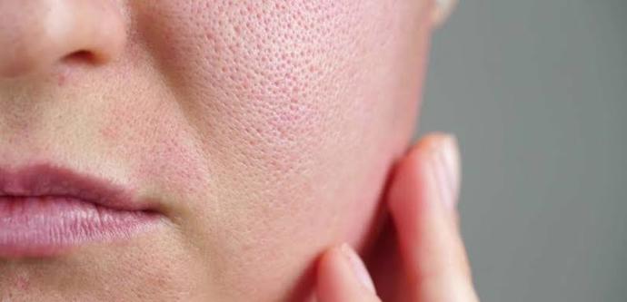 En iyi gözenek sıkılaştırıcı krem, maske, bakım ya da serum hangisi?