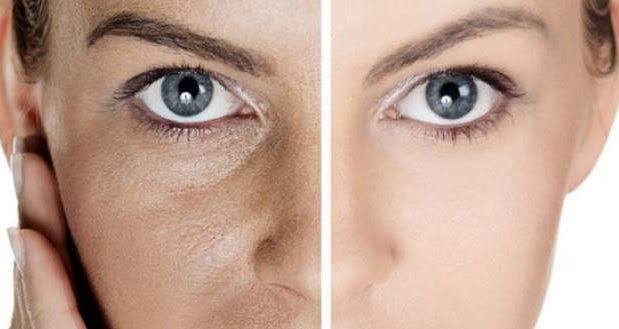 En iyi gözenek sıkılaştırıcı krem, maske, bakım ya da serum hangisi?