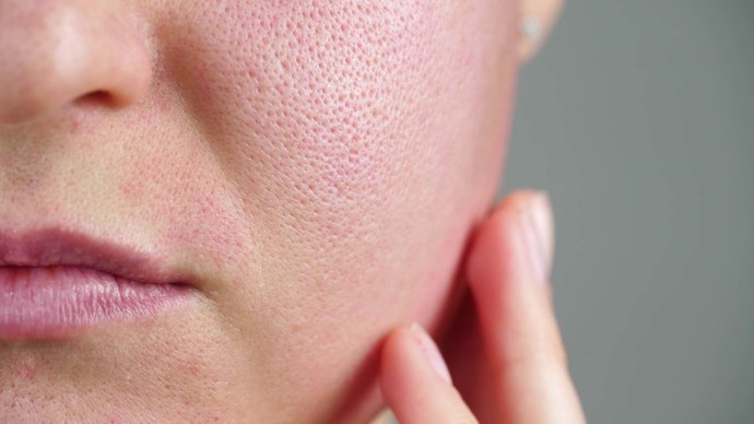 En iyi gözenek sıkılaştırıcı krem, maske, bakım ya da serum hangisi?