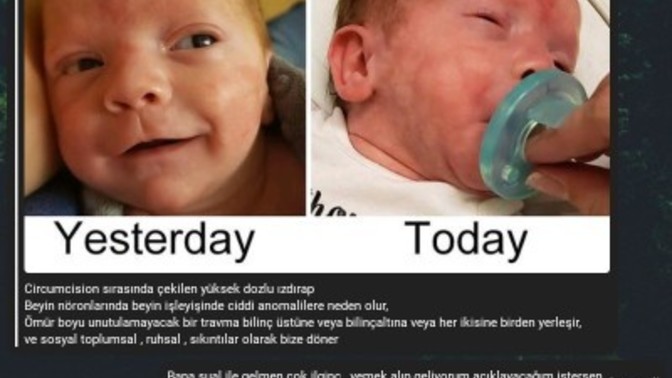 Sünnetin zararlarını biliyor musunuz? Çocuğunuzu sünnet ettirecek misiniz?