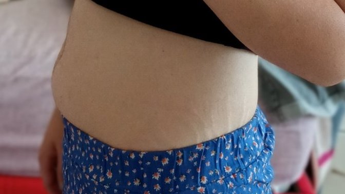 Ya ben 47 kiloda olmama rağmen neden böyle şişiyor karnım çok rahatsız oluyorum. Her akşam yürüyüş yaparım çokta yemek yemem?