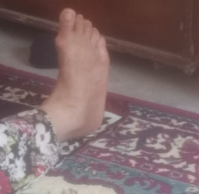 Ayağım nasıl güzel mi?