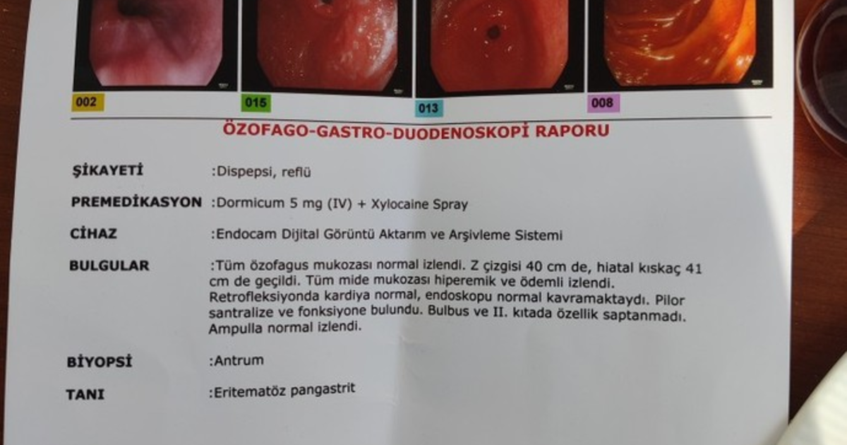 Arkadaşlar, reflü den falan anlayan bi doktor arkadaşlar varsa bana bu