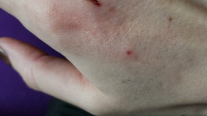 2 saat önce elimi köpek ısırdı, aşı karnesini bulamadık?
