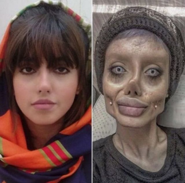 Güzellik için estetik yaptıran insanlar itici mi?