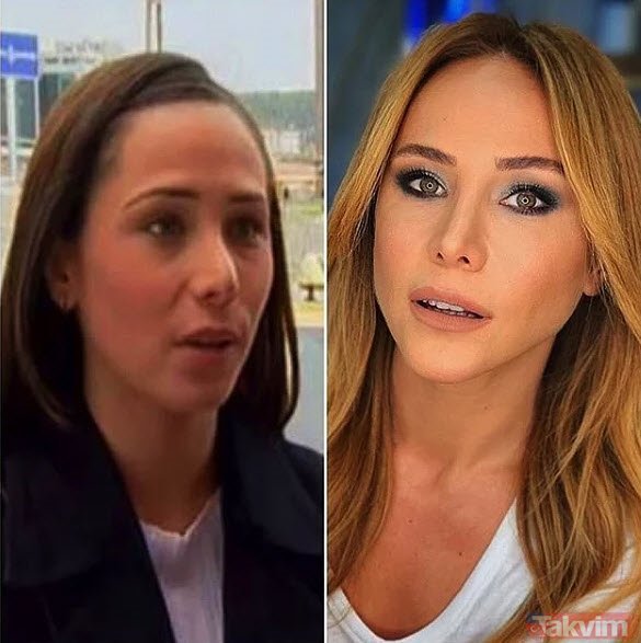 Ünlü isimlerin estetik yaptırmasını mantıklı buluyor musunuz?