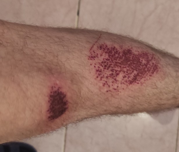 Bi geçmiş olsun alırım 🙄🤦🏻♂️?