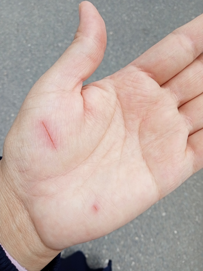 Bedeninizdeki yaralar mi yoksa ruhunuzda ki yaralar mi daha derin?