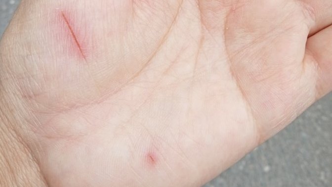 Bedeninizdeki yaralar mi yoksa ruhunuzda ki yaralar mi daha derin?