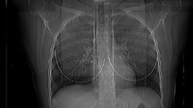 Dalga geçmeyin lütfen! Anlayan cevap verebilir mi?