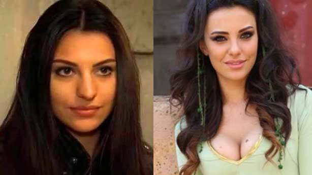 Estetik ile bambaşka olan ünlüler kim?