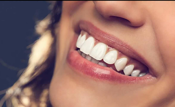 Diş beyazlatmak için bant kullanmalı miyim?