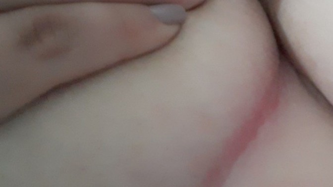 Göğsümün altı ve yanı böyle kızardı acıyor. Pişik mi bu?