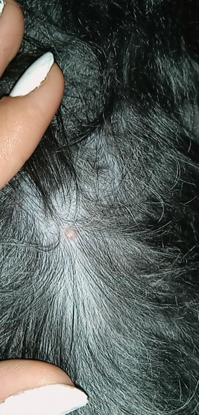 Köpeğimin sırtında sivilce gibi bir şey var, ne olabilir bu?