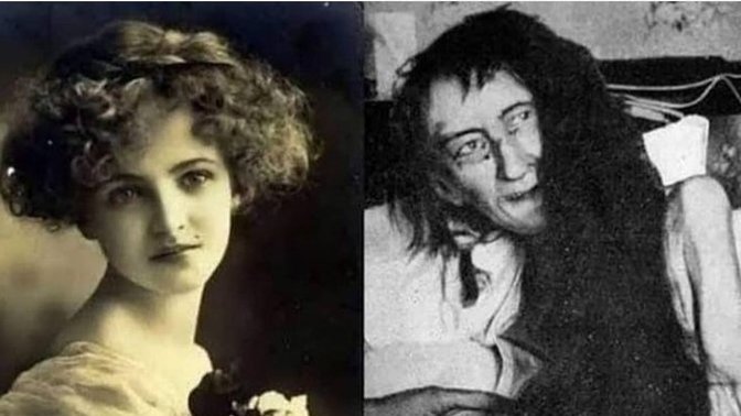 Çocuğunuzu kıskanır mısınız?