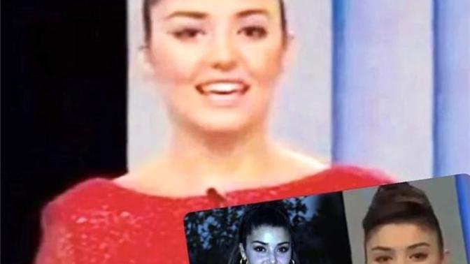 Hande Erçel'in estetiksiz hali hakkında ne düşünüyorsunuz?