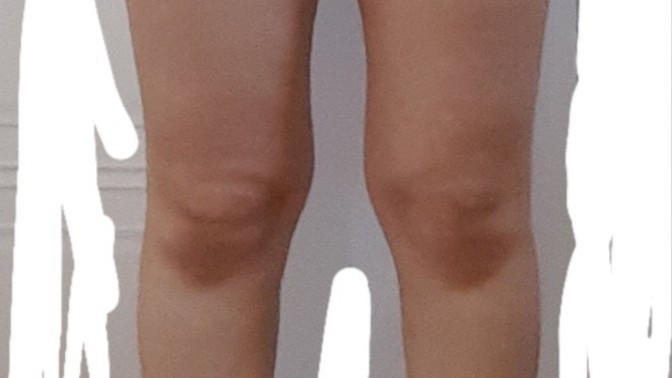 Kaç kilo vermem lazım?