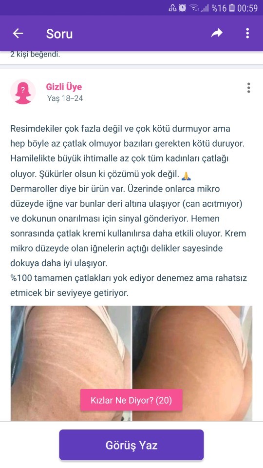 Vücudumdaki çatlaklardan dolayı evlenmeye korkuyorum. Ne yapmalıyım?