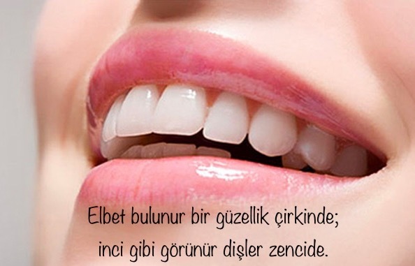 Çirkin dememek lazım
