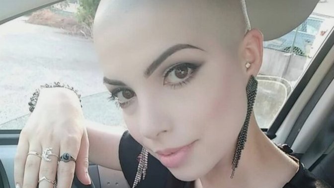 Bir sabah kalkıyorsunuz ve saçlarınız yok kelsiniz! Ayna karşısında vereceğiniz ilk tepki ne olurdu?