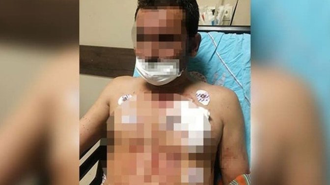 Israrla sosyal medyadan uygunsuz fotoğraflarını paylaşan erkek arkadaşını bıçaklayan kadın tutuklandı. Ne düşünüyorsunuz?