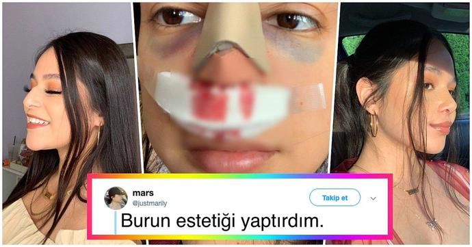 Bir burun ameliyatına 8 bin verir misiniz?