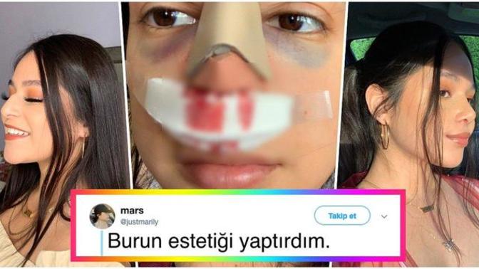 Bir burun ameliyatına 8 bin verir misiniz?