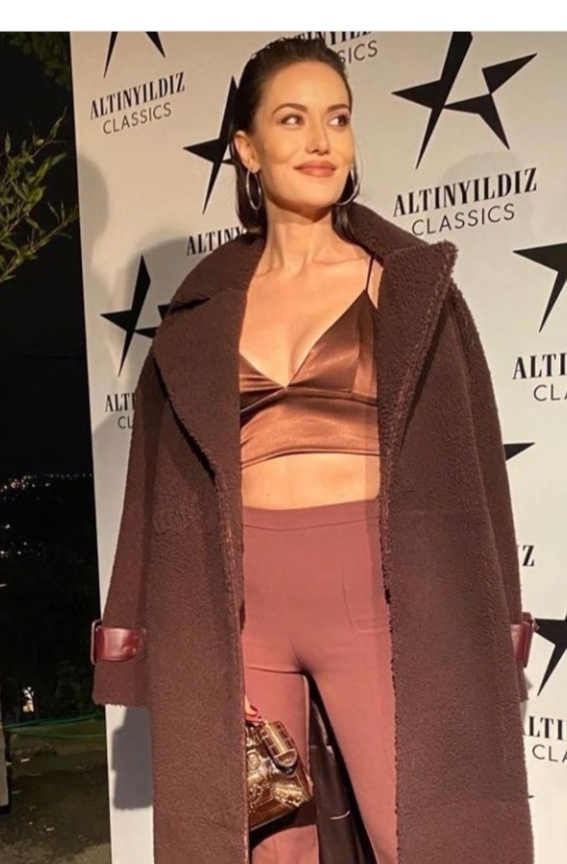 Fahriye Evcenin yüzüne ne olmuş ya, Burak Özçivitle tipleri değişmemiş mi?