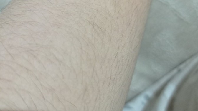 Düğün var kollarımı aldırıp aldırmamak arasında kaldım?