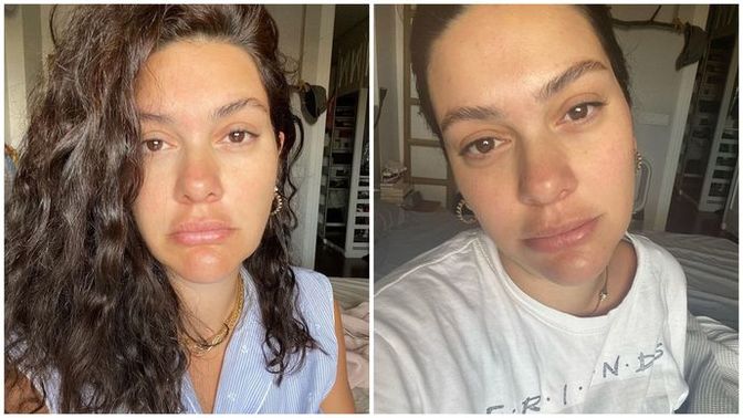 Bergüzar Korel yataktan kalktığı gibi çektiği selfieleri paylaştı! Kadınlar her an güzel mi olmalı?